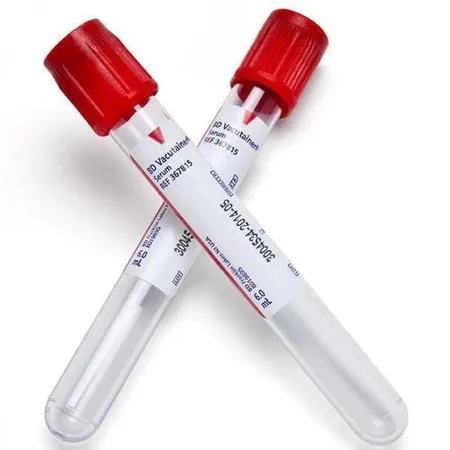 Tube Vacutainer Plus Plastic 13 x 75 mm 4.0 mL Red, 100/Bx