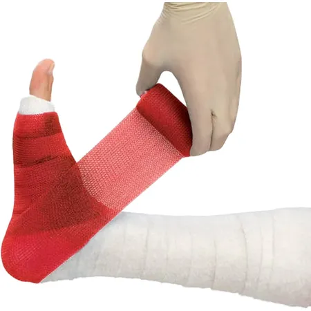 Cast Tape Delta-Lite Plus 2" x 4 yd Red, 10/Bx
