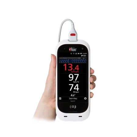 Pulse Co-Oximeter Rad-67™ Battery Operated Visible Alarm, Ea